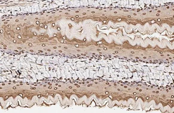 AKT antibody [HL2915] detects AKT protein by immunohistochemical analysis.Sample: Paraffin-embedded rat esophagus.AKT stained by AKT antibody [HL2915] (NBP3-48751) diluted at 1:100.Antigen Retrieval: Citrate buffer, pH 6.0, 15 min 