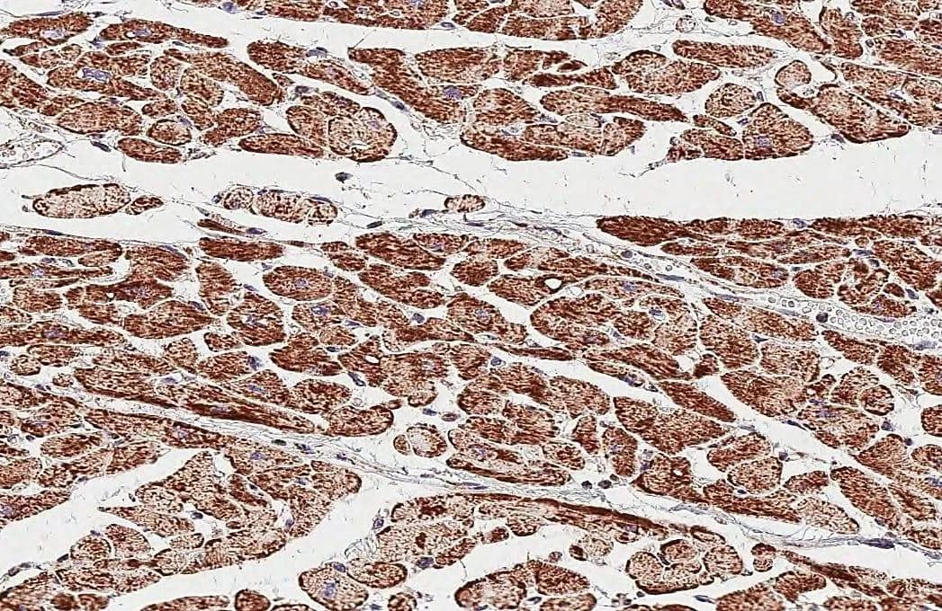 Immunohistochemistry-Paraffin ATP5J Antibody (HL2934)