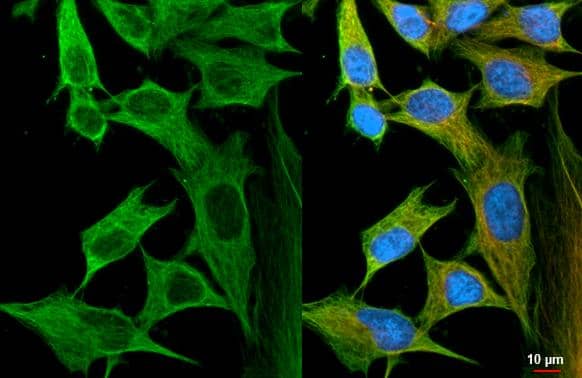 Flightless I antibody [HL2965] detects Flightless I protein by immunofluorescent analysis.Sample: HeLa cells were fixed in ice-cold MeOH for 5 min.Green: Flightless I stained by Flightless I antibody [HL2965] (NBP3-48754) diluted at 1:500.Red: alpha Tubulin, a cytoskeleton marker, stained by alpha Tubulin antibody [GT114] diluted at 1:1000.Blue: Fluoroshield with DAPI . 