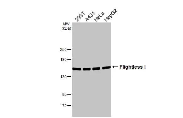 Various whole cell extracts (30 ug) were separated by 5% SDS-PAGE, and the membrane was blotted with Flightless I antibody [HL2965] (NBP3-48754) diluted at 1:1000. The HRP-conjugated anti-rabbit IgG antibody was used to detect the primary antibody. 