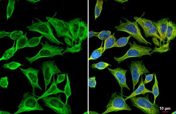 Flightless I antibody [HL2966] detects Flightless I protein by immunofluorescent analysis.Sample: HeLa cells were fixed in ice-cold MeOH for 5 min.Green: Flightless I stained by Flightless I antibody [HL2966] (NBP3-48755) diluted at 1:500.Red: alpha Tubulin, a cytoskeleton marker, stained by alpha Tubulin antibody [GT114] diluted at 1:1000.Blue: Fluoroshield with DAPI . 