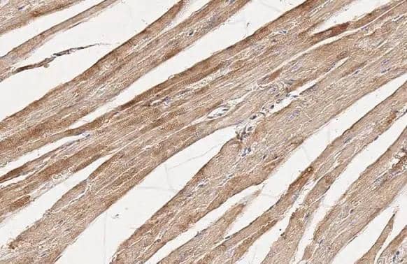 Flightless I antibody [HL2966] detects Flightless I protein by immunohistochemical analysis.Sample: Paraffin-embedded mouse heart.Flightless I stained by Flightless I antibody [HL2966] (NBP3-48755) diluted at 1:100.Antigen Retrieval: Citrate buffer, pH 6.0, 15 min 