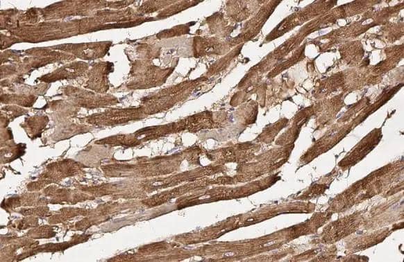 Flightless I antibody [HL2966] detects Flightless I protein by immunohistochemical analysis.Sample: Paraffin-embedded rat heart.Flightless I stained by Flightless I antibody [HL2966] (NBP3-48755) diluted at 1:100.Antigen Retrieval: Citrate buffer, pH 6.0, 15 min 