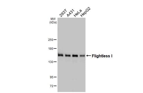 Various whole cell extracts (30 ug) were separated by 5% SDS-PAGE, and the membrane was blotted with Flightless I antibody [HL2966] (NBP3-48755) diluted at 1:1000. The HRP-conjugated anti-rabbit IgG antibody was used to detect the primary antibody. 