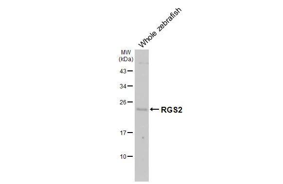 Whole zebrafish extract (30 ug) was separated by 12% SDS-PAGE, and the membrane was blotted with RGS2 antibody [HL2987] (NBP3-48757) diluted at 1:1000. The HRP-conjugated anti-rabbit IgG antibody was used to detect the primary antibody, and the signal was developed with Trident ECL plus-Enhanced. 