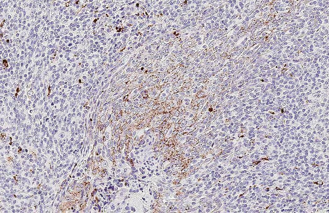 RGS2 antibody [HL2988] detects RGS2 protein by immunohistochemical analysis.Sample: Paraffin-embedded human tonsil.RGS2 stained by RGS2 antibody [HL2988] (NBP3-48758) diluted at 1:200.Antigen Retrieval: Tris-EDTA buffer, pH 9.0, 15 min 