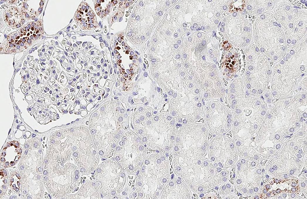 RGS2 antibody [HL2988] detects RGS2 protein by immunohistochemical analysis.Sample: Paraffin-embedded human kidney.RGS2 stained by RGS2 antibody [HL2988] (NBP3-48758) diluted at 1:200.Antigen Retrieval: Tris-EDTA buffer, pH 9.0, 15 min 