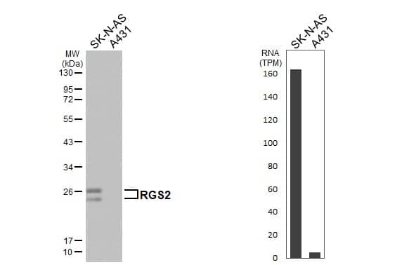 <b>Orthogonal Strategies Validation. </b>Various whole cell extracts (30 ug) were separated by 12% SDS-PAGE, and the membrane was blotted with RGS2 antibody [HL2988] (NBP3-48758) diluted at 1:1000. The HRP-conjugated anti-rabbit IgG antibody was used to detect the primary antibody. Corresponding RNA expression data for the same cell lines are based on Human Protein Atlas program. 