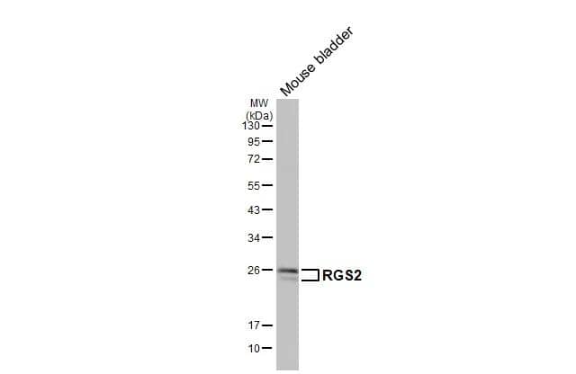 <b>Orthogonal Strategies Validation. </b>Whole tissue extract (50 ug) was separated by 12% SDS-PAGE, and the membrane was blotted with RGS2 antibody [HL2988] (NBP3-48758) diluted at 1:1000. The HRP-conjugated anti-rabbit IgG antibody was used to detect the primary antibody, and the signal was developed with Trident ECL plus-Enhanced. 