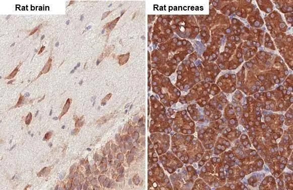 Immunohistochemistry-Paraffin RPL4 Antibody (HL3006)