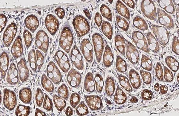 Immunohistochemistry-Paraffin RPL4 Antibody (HL3006)