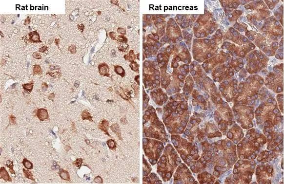 RPL4 antibody [HL3008] detects RPL4 protein by immunohistochemical analysis.Sample: Paraffin-embedded rat tissues.RPL4 stained by RPL4 antibody [HL3008] (NBP3-48760) diluted at 1:100.Antigen Retrieval: Citrate buffer, pH 6.0, 15 min 