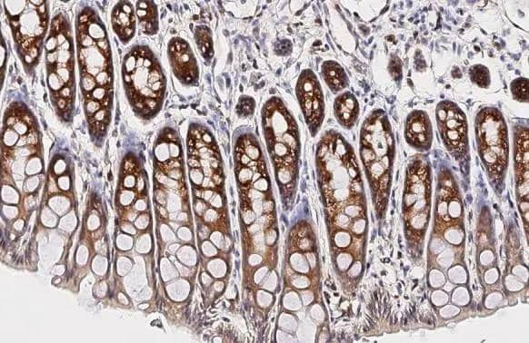 RPL4 antibody [HL3008] detects RPL4 protein by immunohistochemical analysis.Sample: Paraffin-embedded mouse colon.RPL4 stained by RPL4 antibody [HL3008] (NBP3-48760) diluted at 1:100.Antigen Retrieval: Citrate buffer, pH 6.0, 15 min 