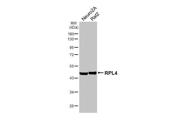 Various whole cell extracts (30 ug) were separated by 10% SDS-PAGE, and the membrane was blotted with RPL4 antibody [HL3008] (NBP3-48760) diluted at 1:1000. The HRP-conjugated anti-rabbit IgG antibody was used to detect the primary antibody. 