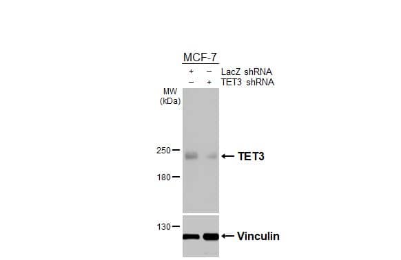 <b>Genetic Strategies Validation. </b>Non-transfected (-) and transfected (+) MCF-7 whole cell extracts (30 ug) were separated by 5% SDS-PAGE, and the membrane was blotted with TET3 antibody [HL3009] (NBP3-48761) diluted at 1:1000. The HRP-conjugated anti-rabbit IgG antibody was used to detect the primary antibody, and the signal was developed with Trident ECL plus-Enhanced. 