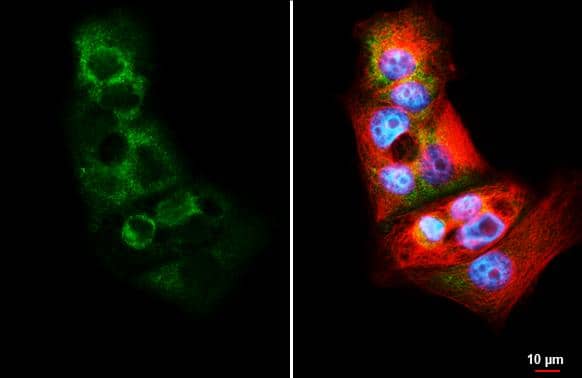 RPS26 antibody [HL3013] detects RPS26 protein by immunofluorescent analysis.Sample: HeLa cells were fixed in 4% paraformaldehyde at RT for 15 min.Green: RPS26 stained by RPS26 antibody [HL3013] (NBP3-48762) diluted at 1:500.Red: alpha Tubulin, a cytoskeleton marker, stained by alpha Tubulin antibody [GT114] diluted at 1:1000.Blue: Fluoroshield with DAPI . 