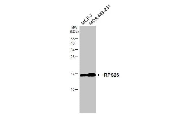 Various whole cell extracts (30 ug) were separated by 15% SDS-PAGE, and the membrane was blotted with RPS26 antibody [HL3013] (NBP3-48762) diluted at 1:1000. The HRP-conjugated anti-rabbit IgG antibody was used to detect the primary antibody, and the signal was developed with Trident femto Western HRP Substrate. 