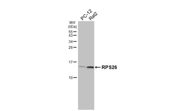 Various whole cell extracts (30 ug) were separated by 15% SDS-PAGE, and the membrane was blotted with RPS26 antibody [HL3013] (NBP3-48762) diluted at 1:1000. The HRP-conjugated anti-rabbit IgG antibody was used to detect the primary antibody. 