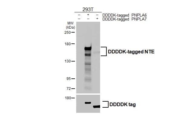 Western Blot PNPLA6 Antibody (HL3127)