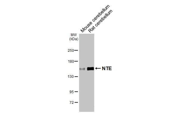Western Blot PNPLA6 Antibody (HL3127)