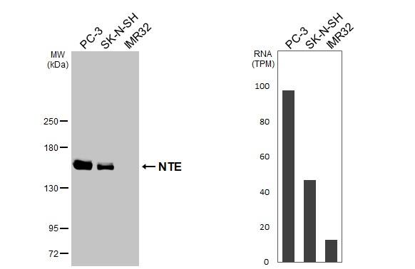 Western Blot PNPLA6 Antibody (HL3127)