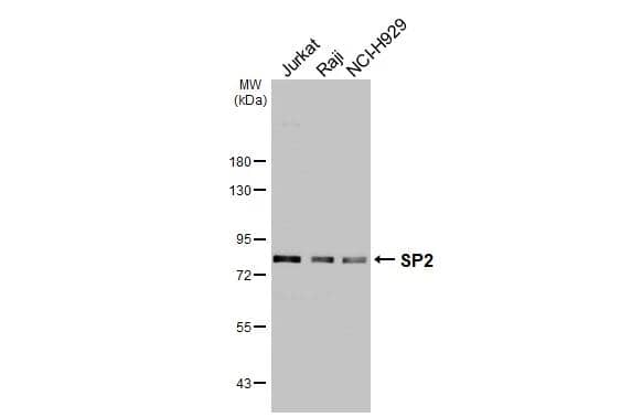 <b>Orthogonal Strategies Validation. </b>Various whole cell extracts (30 ug) were separated by 7.5% SDS-PAGE, and the membrane was blotted with SP2 antibody [HL3155] (NBP3-48772) diluted at 1:1000. The HRP-conjugated anti-rabbit IgG antibody was used to detect the primary antibody. 