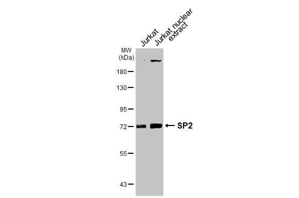 Jurkat whole cell and nuclear extracts (30 ug) were separated by 7.5% SDS-PAGE, and the membrane was blotted with SP2 antibody [HL3155] (NBP3-48772) diluted at 1:1000. The HRP-conjugated anti-rabbit IgG antibody was used to detect the primary antibody. 