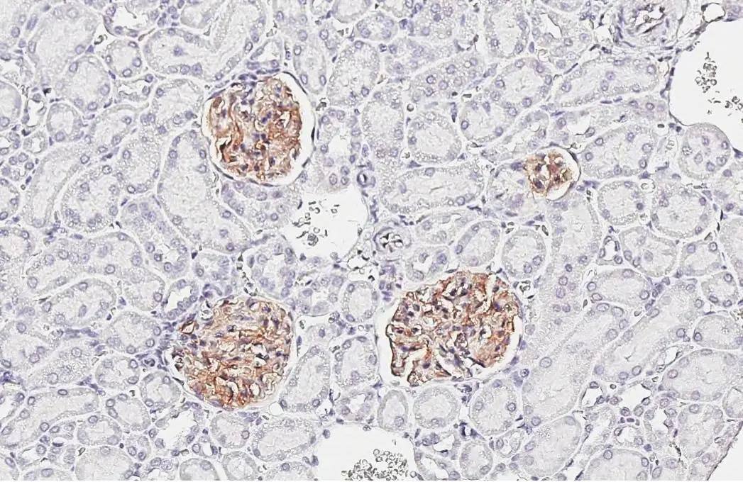 Claudin-5 antibody [HL3156] detects Claudin-5 protein by immunohistochemical analysis.Sample: Paraffin-embedded rat kidney.Claudin-5 stained by Claudin-5 antibody [HL3156] (NBP3-48773) diluted at 1:2000.Antigen Retrieval: Tris-EDTA buffer, pH 9.0, 15 min 