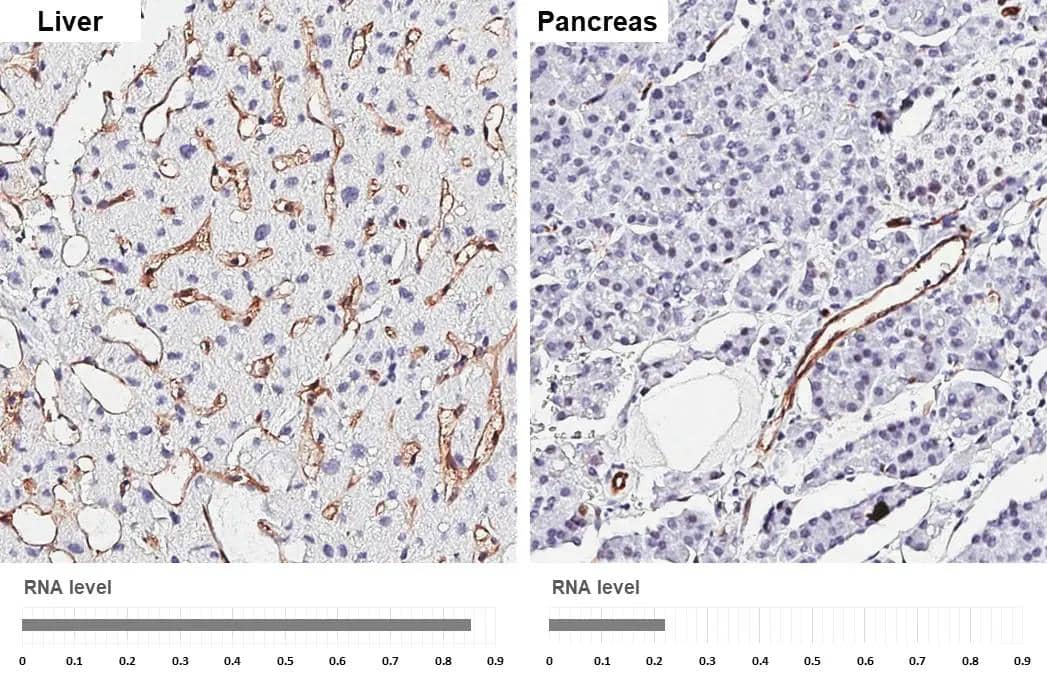 <b>Orthogonal Strategies Validation. </b>Claudin-5 antibody [HL3156] detects Claudin-5 protein by immunohistochemical analysis.Sample: Paraffin-embedded human tissues.Claudin-5 stained by Claudin-5 antibody [HL3156] (NBP3-48773) diluted at 1:3200.Antigen Retrieval: Tris-EDTA buffer, pH 9.0, 15 min 