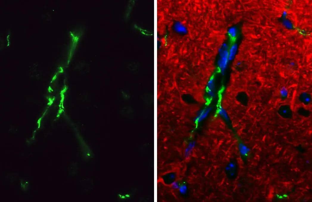 Claudin-5 antibody [HL3156] detects Claudin-5 protein by immunohistochemical analysis.Sample: Paraffin-embedded mouse brain.Green: Claudin-5 stained by Claudin-5 antibody [HL3156] (NBP3-48773) diluted at 1:2000.Red: beta Tubulin 3/ Tuj1 antibody [GT11710] diluted at 1:500.Blue: Fluoroshield with DAPI .Antigen Retrieval: Tris-EDTA buffer, pH 9.0, 15 min 