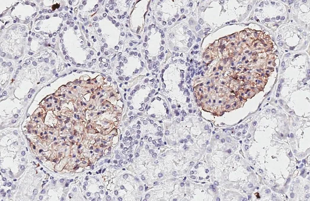 Claudin-5 antibody [HL3156] detects Claudin-5 protein by immunohistochemical analysis.Sample: Paraffin-embedded human kidney.Claudin-5 stained by Claudin-5 antibody [HL3156] (NBP3-48773) diluted at 1:3200.Antigen Retrieval: Tris-EDTA buffer, pH 9.0, 15 min 