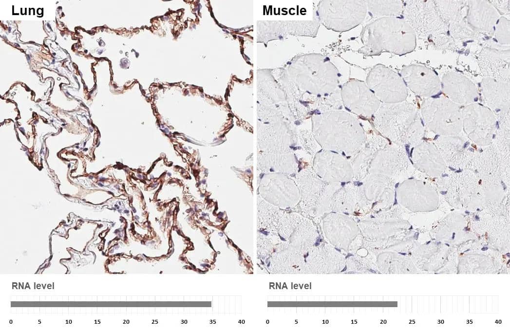 Claudin-5 antibody [HL3156] detects Claudin-5 protein by immunohistochemical analysis.Sample: Paraffin-embedded human tissues.Claudin-5 stained by Claudin-5 antibody [HL3156] (NBP3-48773) diluted at 1:3200.Antigen Retrieval: Tris-EDTA buffer, pH 9.0, 15 min 