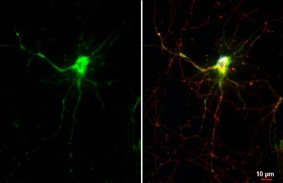 Immunocytochemistry/ Immunofluorescence Maxi Potassium channel alpha Antibody (HL3164)