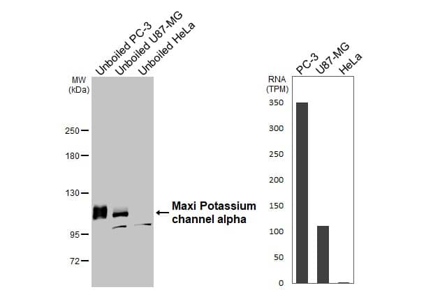 Unboiled various whole cell extracts (30 ug) were separated by 5% SDS-PAGE, and the membrane was blotted with Maxi Potassium channel alpha antibody [HL3164] (NBP3-48775) diluted at 1:1000. The HRP-conjugated anti-rabbit IgG antibody was used to detect the primary antibody. Corresponding RNA expression data for the same cell lines are based on Human Protein Atlas program. 