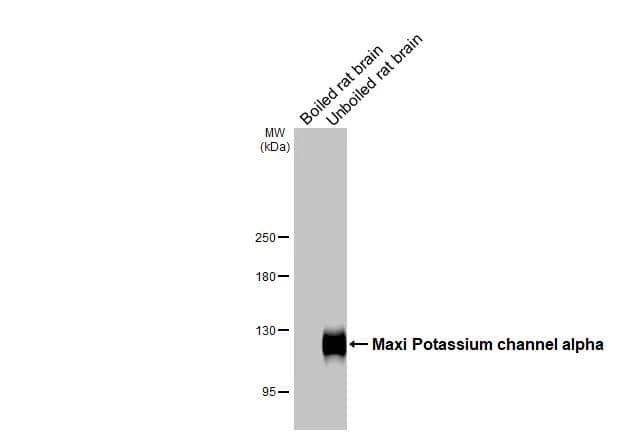 Western Blot Maxi Potassium channel alpha Antibody (HL3164)