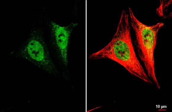 LSM4 antibody [HL3172] detects LSM4 protein by immunofluorescent analysis.Sample: HeLa cells were fixed in 4% paraformaldehyde at RT for 15 min.Green: LSM4 stained by LSM4 antibody [HL3172] (NBP3-48776) diluted at 1:500.Red: alpha Tubulin, a cytoskeleton marker, stained by alpha Tubulin antibody [GT114] diluted at 1:1000. 