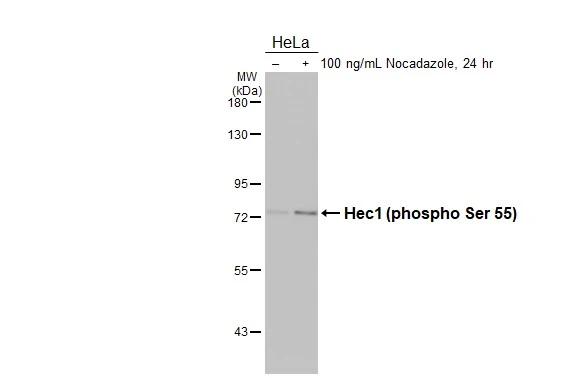Untreated (-) and treated (+) HeLa whole cell extracts (30 ug) were separated by 7.5% SDS-PAGE, and the membrane was blotted with NDC80 antibody [HL3190] (NBP3-48778) diluted at 1:1000. The HRP-conjugated anti-rabbit IgG antibody was used to detect the primary antibody. 