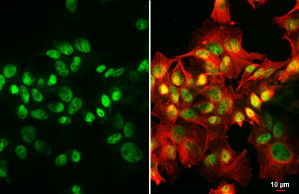 HNF1 antibody [HL3229] detects HNF1 protein by immunofluorescent analysis.Sample: HepG2 cells were fixed in 4% paraformaldehyde at RT for 15 min.Green: HNF1 stained by HNF1 antibody [HL3229] (NBP3-48780) diluted at 1:500.Red: alpha Tubulin, a cytoskeleton marker, stained by alpha Tubulin antibody [GT114] diluted at 1:1000. 
