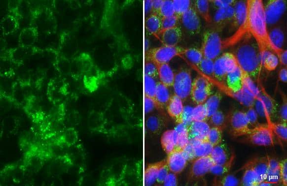 Immunocytochemistry/ Immunofluorescence Seladin 1 Antibody (HL3253)