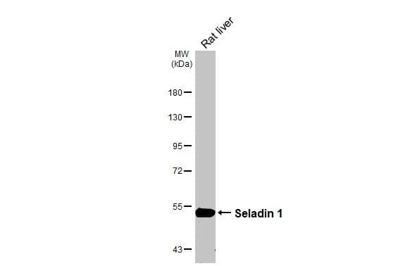 Western Blot Seladin 1 Antibody (HL3253)