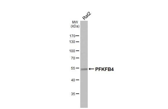 Whole cell extract (30 ug) was separated by 10% SDS-PAGE, and the membrane was blotted with PFKFB4 antibody [HL3254] (NBP3-48782) diluted at 1:1000. The HRP-conjugated anti-rabbit IgG antibody was used to detect the primary antibody. 