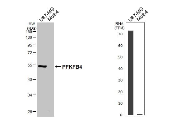 <b>Orthogonal Strategies Validation. </b>Various whole cell extracts (30 ug) were separated by 10% SDS-PAGE, and the membrane was blotted with PFKFB4 antibody [HL3254] (NBP3-48782) diluted at 1:1000. The HRP-conjugated anti-rabbit IgG antibody was used to detect the primary antibody. Corresponding RNA expression data for the same cell lines are based on Human Protein Atlas program. 