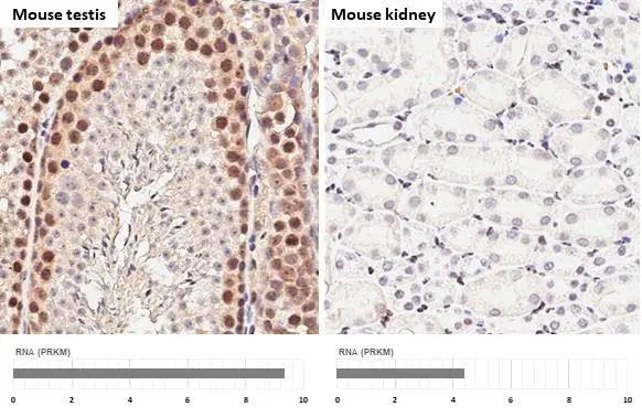 <b>Orthogonal Strategies Validation. </b>SETDB1 antibody [HL3259] detects SETDB1 protein by immunohistochemical analysis.Sample: Paraffin-embedded mouse tissues.SETDB1 stained by SETDB1 antibody [HL3259] (NBP3-48783) diluted at 1:100.Antigen Retrieval: Citrate buffer, pH 6.0, 15 minCorresponding RNA expression data for the same tissues are based on NCBI. 