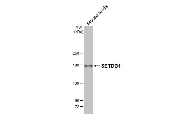 Mouse tissue extract (50 ug) was separated by 5% SDS-PAGE, and the membrane was blotted with SETDB1 antibody [HL3259] (NBP3-48783) diluted at 1:1000. The HRP-conjugated anti-rabbit IgG antibody was used to detect the primary antibody. 