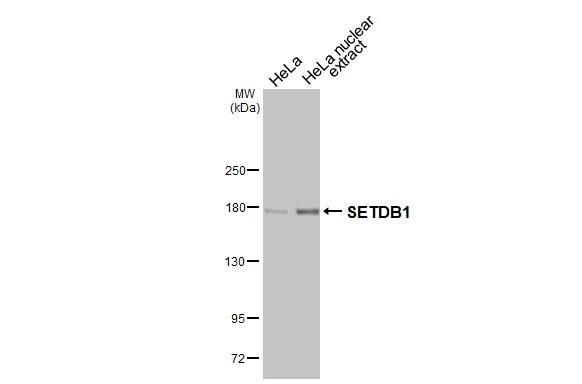HeLa whole cell and nuclear extract (30 ug) were separated by 5% SDS-PAGE, and the membrane was blotted with SETDB1 antibody [HL3259] (NBP3-48783) diluted at 1:1000. The HRP-conjugated anti-rabbit IgG antibody was used to detect the primary antibody. 