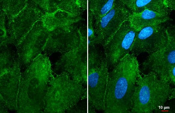 Immunocytochemistry/ Immunofluorescence alpha-1D Adrenergic R/ADRA1D Antibody (HL3267)