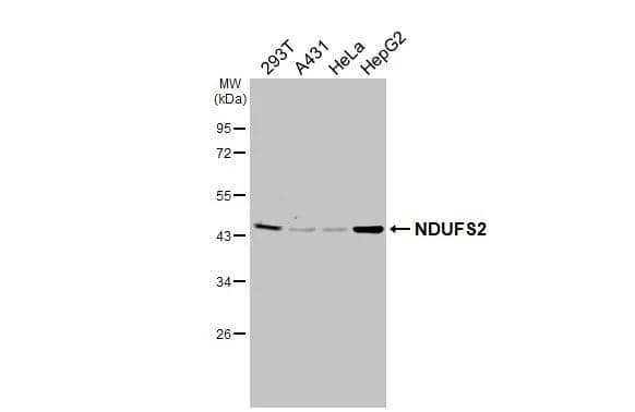 Various whole cell extracts (30 ug) were separated by 10% SDS-PAGE, and the membrane was blotted with NDUFS2 antibody [HL3269] (NBP3-48785) diluted at 1:1000. The HRP-conjugated anti-rabbit IgG antibody was used to detect the primary antibody. 