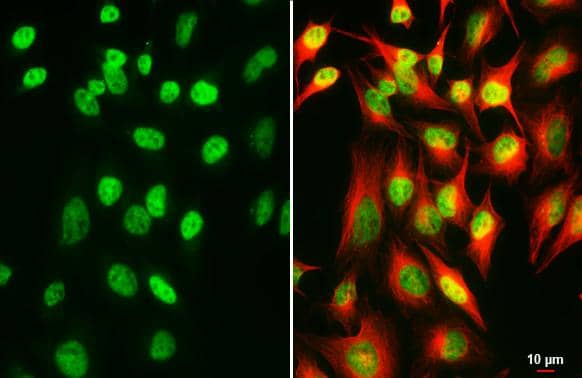 SP2 antibody [HL3271] detects SP2 protein by immunofluorescent analysis.Sample: HeLa cells were fixed in 4% paraformaldehyde at RT for 15 min.Green: SP2 stained by SP2 antibody [HL3271] (NBP3-48786) diluted at 1:500.Red: alpha Tubulin, a cytoskeleton marker, stained by alpha Tubulin antibody [GT114] diluted at 1:1000. 