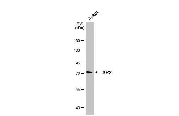 Whole cell extract (30 ug) was separated by 7.5% SDS-PAGE, and the membrane was blotted with SP2 antibody [HL3271] (NBP3-48786) diluted at 1:1000. The HRP-conjugated anti-rabbit IgG antibody was used to detect the primary antibody. 