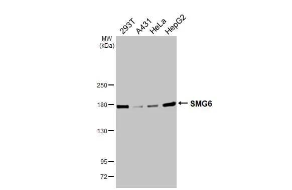Various whole cell extracts (30 ug) were separated by 5% SDS-PAGE, and the membrane was blotted with SMG6 antibody [HL3274] (NBP3-48787) diluted at 1:1000. The HRP-conjugated anti-rabbit IgG antibody was used to detect the primary antibody. 